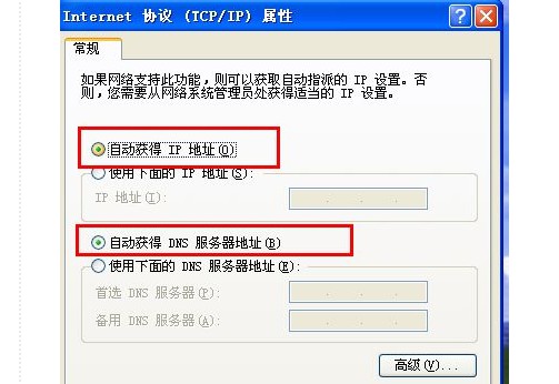 f-自動獲取IP地址和自動獲得DNS服務(wù)器地址